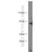 ACSM3 Rabbit Polyclonal Antibody (10168-2-AP)