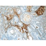 KRT15 Rabbit Polyclonal Antibody (10137-1-AP)