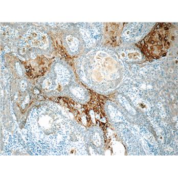 KRT15 Rabbit Polyclonal Antibody (10137-1-AP)