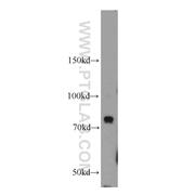 BCAS3 Rabbit Polyclonal Antibody (10402-1-AP)