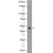 AURKA Rabbit Polyclonal Antibody (10297-1-AP)