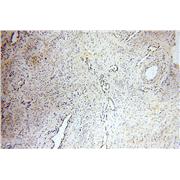 PLK1 Rabbit Polyclonal Antibody (10305-1-AP)