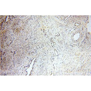 PLK1 Rabbit Polyclonal Antibody (10305-1-AP)