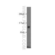 GTF2A2 Rabbit Polyclonal Antibody (10540-1-AP)