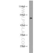 CSTF1 Rabbit Polyclonal Antibody (10064-2-AP)