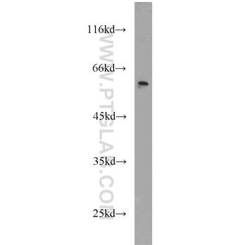 CSTF1 Rabbit Polyclonal Antibody (10064-2-AP)