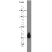CPLX1 Rabbit Polyclonal Antibody (10246-2-AP)