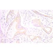 CRADD Rabbit Polyclonal Antibody (10401-1-AP)