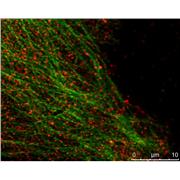 MAPRE2 Rabbit Polyclonal Antibody (10364-1-AP)