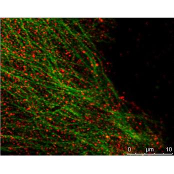 MAPRE2 Rabbit Polyclonal Antibody (10364-1-AP)