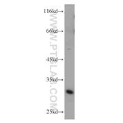 ZMAT3 Rabbit Polyclonal Antibody (10504-1-AP)