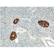 CHGA Rabbit Polyclonal Antibody (10529-1-AP)