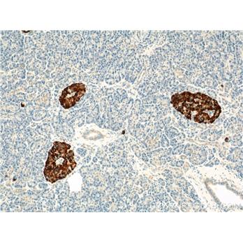 CHGA Rabbit Polyclonal Antibody (10529-1-AP)