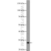 SIRT3 Rabbit Polyclonal Antibody (10099-1-AP)