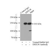 DHX38 Rabbit Polyclonal Antibody (10098-2-AP)