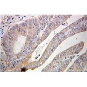 ABCF2 Rabbit Polyclonal Antibody (10226-1-AP)