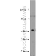 CYTH2 Rabbit Polyclonal Antibody (10405-1-AP)