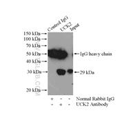 UCK2 Rabbit Polyclonal Antibody (10511-1-AP)