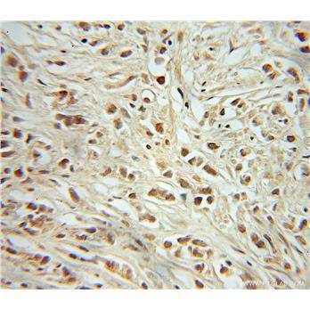RB1 Rabbit Polyclonal Antibody (10048-2-Ig)