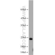 RAB6B Rabbit Polyclonal Antibody (10340-1-AP)