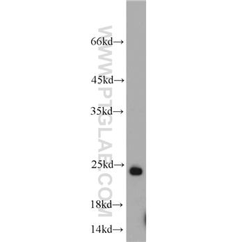 RAB6B Rabbit Polyclonal Antibody (10340-1-AP)