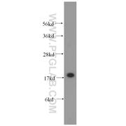 CDKN2D Rabbit Polyclonal Antibody (10272-2-AP)
