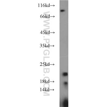 PPIC Rabbit Polyclonal Antibody (10287-2-AP)