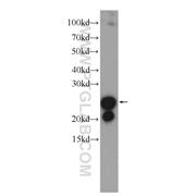 TAGLN Rabbit Polyclonal Antibody (10493-1-AP)