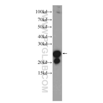TAGLN Rabbit Polyclonal Antibody (10493-1-AP)