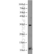 TFPT Rabbit Polyclonal Antibody (10097-2-AP)