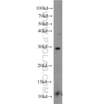 TFPT Rabbit Polyclonal Antibody (10097-2-AP)