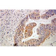FKBP1A Rabbit Polyclonal Antibody (10273-1-AP)