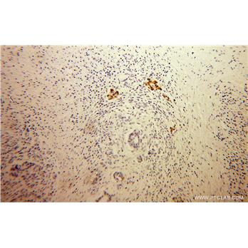 MPV17 Rabbit Polyclonal Antibody (10310-1-AP)