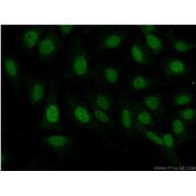 PAX8 Rabbit Polyclonal Antibody (10336-1-AP)