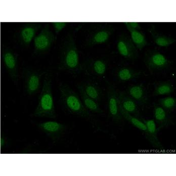 PAX8 Rabbit Polyclonal Antibody (10336-1-AP)