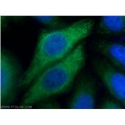 KRT14 Rabbit Polyclonal Antibody (10143-1-AP)