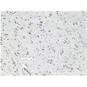 MAPT Rabbit Polyclonal Antibody (10274-1-AP)