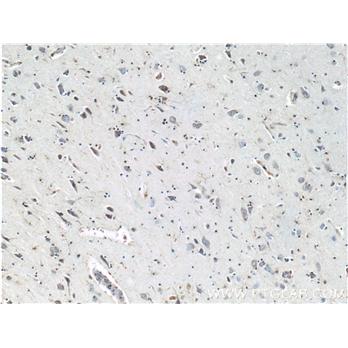 MAPT Rabbit Polyclonal Antibody (10274-1-AP)