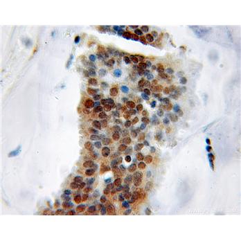 KHDRBS1 Rabbit Polyclonal Antibody (10222-1-AP)