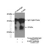 GAD1 Rabbit Polyclonal Antibody (10408-1-AP)