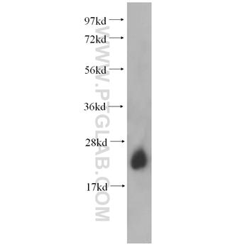 RAB6A Rabbit Polyclonal Antibody (10187-2-AP)
