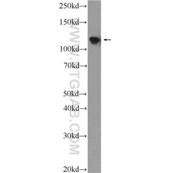 NOP2 Rabbit Polyclonal Antibody (10448-1-AP)
