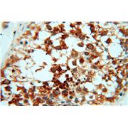 RUVBL2 Rabbit Polyclonal Antibody (10195-1-AP)