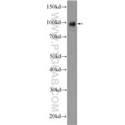 TTK Rabbit Polyclonal Antibody (10381-1-AP)