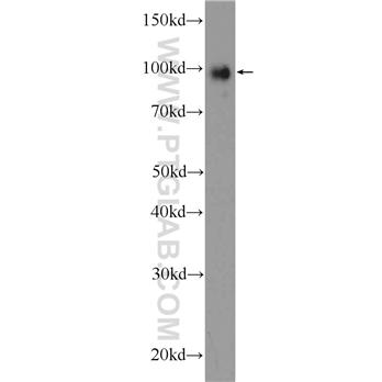 TTK Rabbit Polyclonal Antibody (10381-1-AP)