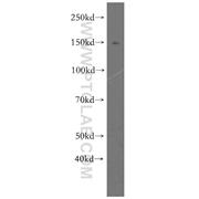 FMNL1 Rabbit Polyclonal Antibody (10395-1-AP)