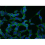 CNOT2 Rabbit Polyclonal Antibody (10313-1-AP)