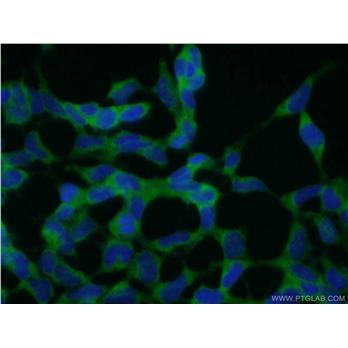 CNOT2 Rabbit Polyclonal Antibody (10313-1-AP)