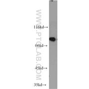 NCBP1 Rabbit Polyclonal Antibody (10349-1-AP)