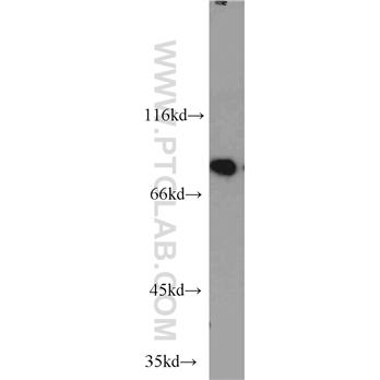 NCBP1 Rabbit Polyclonal Antibody (10349-1-AP)